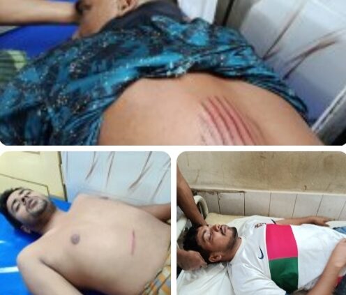 টাঙ্গাইলের কালিহাতীতে জমি সংক্রান্ত বিরোধে সন্ত্রাসীদের হামলায় আহত দেলোয়ার হোসেন, আবদুল্লাহ আল-মামুন, ইয়াছির আরাফাত